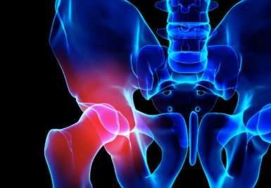 No longer living life with hip pain