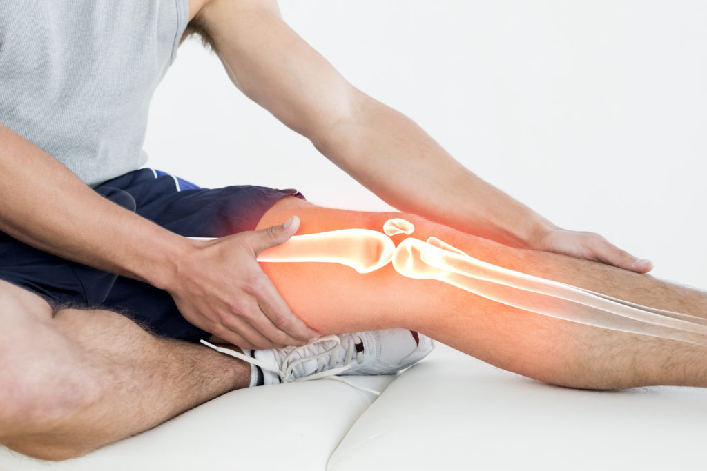 What causes recurrent patellar (knee cap) dislocations?