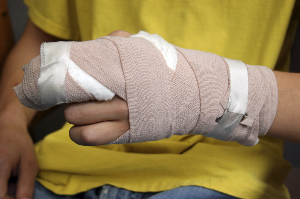 Hand injuries and sports