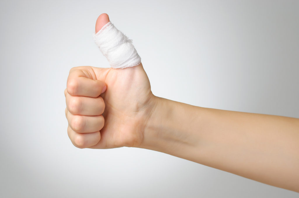 How long does a sprained thumb take to heal?