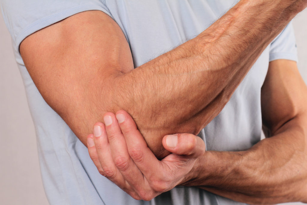 What is a torn bicep tendon at the elbow?