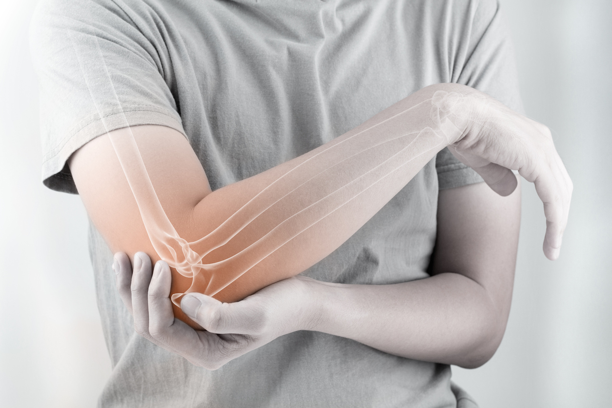 Total Elbow Replacement Pros and Cons OrthoIndy Blog