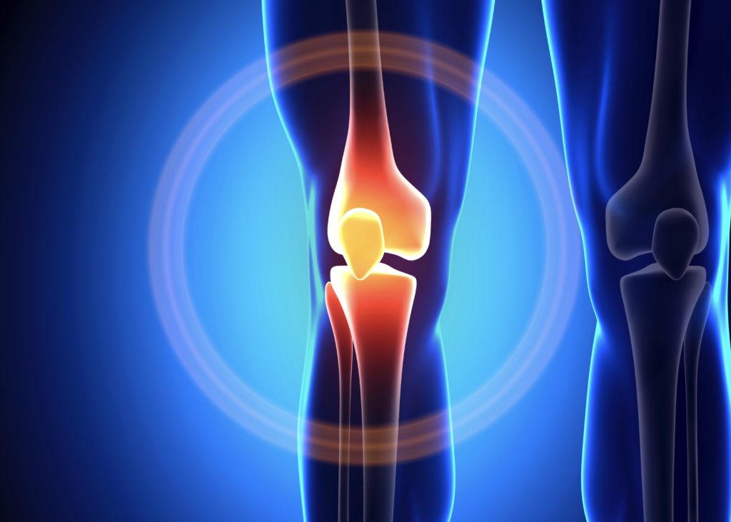 An alternative to knee surgery: ReNu Knee injection trial