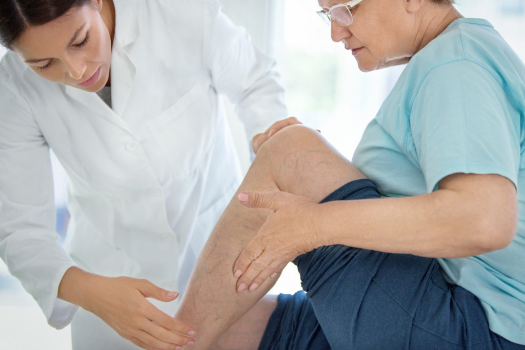 What is compartment syndrome?