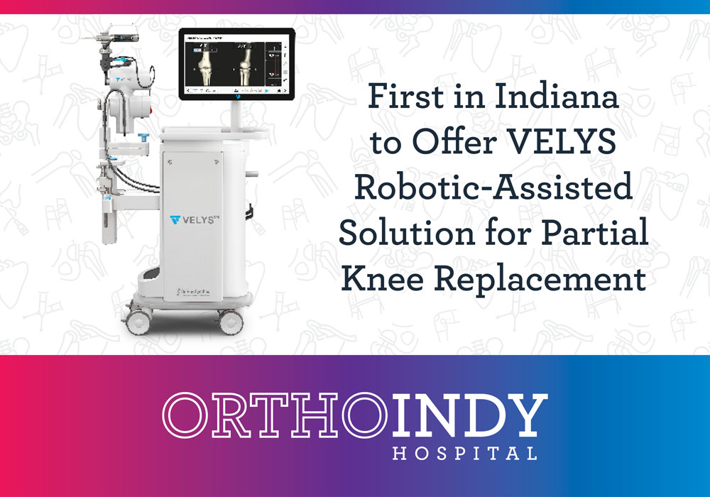 OrthoIndy Becomes the First in Indiana to Offer VELYS Robotic-Assisted Solution for Partial Knee Replacement